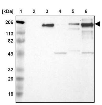 Western Blot: Laminin S/Laminin beta 2 Antibody [NBP1-87717] - Lane 1: Marker  [kDa] 206, 113, 82, 49, 32, 26, 18.   Lane 2: Human cell line RT-4.  Lane 3: Human cell line U-251MG sp.  Lane 4: Human cell line A-431.  Lane 5: Human liver tissue.  Lane 6: Human tonsil tissue