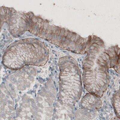 Immunohistochemistry-Paraffin: Laminin alpha 3 Antibody (CL3112) [NBP2-42390] - Staining of human stomach shows moderate immunoreactivity in basement membrane of glandular epithelium.