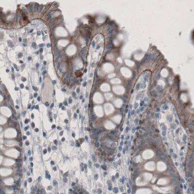 Immunohistochemistry-Paraffin: Laminin alpha 3 Antibody (CL3112) [NBP2-42390] - Staining of human colon shows positivity in basement membrane of glandular epithelium.