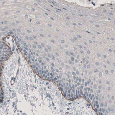 Immunohistochemistry-Paraffin: Laminin alpha 3 Antibody (CL3112) [NBP2-42390] - Staining of human oral mucosa shows moderate immunoreactivity in basement membrane of squamous epithelium.