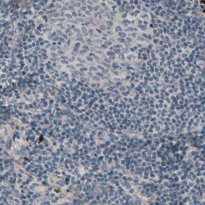 Immunohistochemistry-Paraffin: Laminin alpha 3 Antibody (CL3112) [NBP2-42390] - Staining of human lymph node shows absence of positivity in lymphoid tissue (negative control).