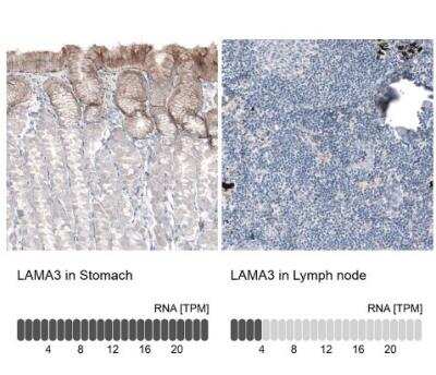 Immunohistochemistry-Paraffin: Laminin alpha 3 Antibody (CL3112) [NBP2-42390] - Analysis in human stomach and lymph node tissues using NBP2-42390 antibody. Corresponding LAMA3 RNA-seq data are presented for the same tissues.