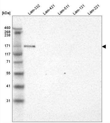 <b>Orthogonal Strategies Validation. </b>Western Blot: Laminin alpha 3 Antibody (CL3112) [NBP2-42390] - Analysis of purified human recombinant Laminin-332, Laminin-421, Laminin-511, Laminin-121 and Laminin-221.