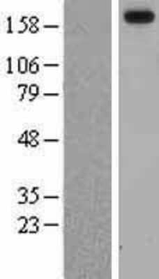 Western Blot: Laminin alpha 3 Overexpression Lysate (Adult Normal) [NBL1-12428] Left-Empty vector transfected control cell lysate (HEK293 cell lysate); Right -Over-expression Lysate for Laminin alpha 3.