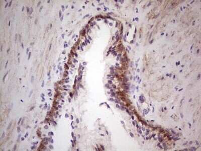 Immunohistochemistry: Laminin alpha 4 Antibody (OTI5G8) - Azide and BSA Free [NBP2-71113] - Analysis of Human prostate tissue.