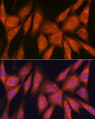 Immunocytochemistry/Immunofluorescence: Laminin beta 1 Antibody (6I9T4) [NBP3-16392] - Immunofluorescence analysis of NIH-3T3 cells using Laminin beta 1 Rabbit mAb (NBP3-16392) at dilution of 1:100 (40x lens). Blue: DAPI for nuclear staining.