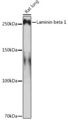 Western Blot: Laminin beta 1 Antibody (6I9T4) [NBP3-16392] - Western blot analysis of extracts of Rat lung, using Laminin beta 1 Rabbit mAb (NBP3-16392) at 1:1000 dilution. Secondary antibody: HRP Goat Anti-Rabbit IgG (H+L) at 1:10000 dilution. Lysates/proteins: 25ug per lane. Blocking buffer: 3% nonfat dry milk in TBST. Detection: ECL Basic Kit. Exposure time: 3min.