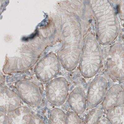 Immunohistochemistry-Paraffin: Laminin beta 1 Antibody (CL2970) [NBP2-42385] - Staining of human stomach shows positivity in basement membrane of glandular epithelium.