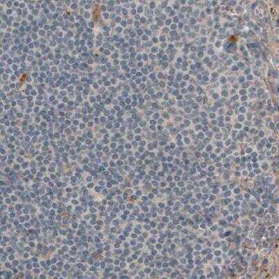 Immunohistochemistry-Paraffin: Laminin beta 1 Antibody (CL2970) [NBP2-42385] - Staining of human lymph node shows absence of immunoreactivity in lymphoid cells (negative control).