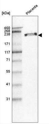 Western Blot: Laminin beta 1 Antibody (CL2970) [NBP2-42385] - Analysis in human placenta tissue.