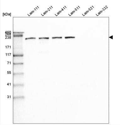 Western Blot: Laminin beta 1 Antibody (CL2970) [NBP2-42385] - Analysis of purified human recombinant Laminin-111, Laminin-211, Laminin-411, Laminin-511, Laminin-521 and Laminin-332.