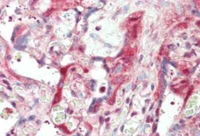 Immunohistochemistry: Laminin beta 1 Antibody [NB120-6571] - Tissue: skin. Fixation: formalin fixed paraffin embedded. Primary antibody: Anti-Laminin at 5 ug/mL for 1 h at RT. Secondary antibody: Peroxidase rabbit secondary antibody at 1:10,000 for 45 min at RT. Staining: Laminin as precipitated red signal with hematoxylin purple nuclear counterstain.