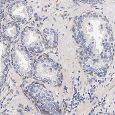 Immunohistochemistry-Paraffin: Laminin beta 1 Antibody [NBP1-88073] - Staining of human prostate shows low expression as expected.