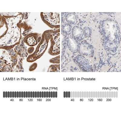 Immunohistochemistry-Paraffin: Laminin beta 1 Antibody [NBP1-88073] - Staining in human placenta and prostate tissues using anti-LAMB1 antibody. Corresponding LAMB1 RNA-seq data are presented for the same tissues.