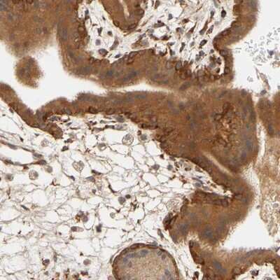 Immunohistochemistry-Paraffin: Laminin beta 1 Antibody [NBP1-88074] - Staining of human placenta shows strong cytoplasmic and membranous positivity in trophoblastic cells.