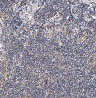 Immunohistochemistry-Paraffin: Laminin beta 1 Antibody [NBP1-88074] - Staining of human tonsil shows no cytoplasmic positivity in non-germinal center cells as expected.