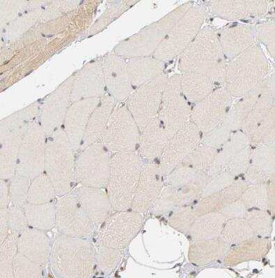 Immunohistochemistry-Paraffin: Laminin beta 1 Antibody [NBP1-88074] - Staining of human skeletal muscle shows very weak cytoplasmic positivity in myocytes.