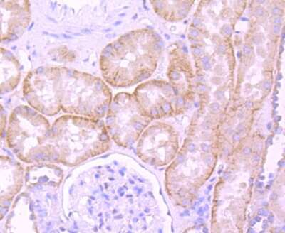 Immunohistochemistry-Paraffin: Laminin beta 1 Antibody (JM099-03) [NBP2-66926] - Analysis of paraffin-embedded human kidney tissue using anti-Laminin beta 1 antibody. Counter stained with hematoxylin.