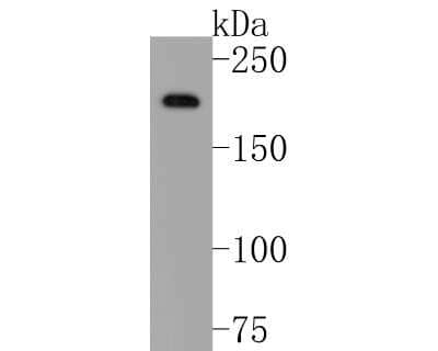 Western Blot: Laminin beta 1 Antibody (JM099-03) [NBP2-66926] - Western blot analysis of Laminin beta 1 on A431 cell lysates. Proteins were transferred to a PVDF membrane and blocked with 5% BSA in PBS for 1 hour at room temperature. The primary antibody (1/500) was used in 5% BSA at room temperature for 2 hours. Goat Anti-Rabbit IgG - HRP Secondary Antibody (HA1001) at 1:200,000 dilution was used for 1 hour at room temperature.