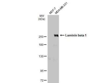 Western Blot: Laminin beta 1 Antibody [NBP1-32043] - Various whole cell extracts (30 ug) were separated by 5% SDS-PAGE, and the membrane was blotted with Laminin beta 1 antibody diluted at 1:1000. The HRP-conjugated anti-rabbit IgG antibody (NBP2-19301) was used to detect the primary antibody.