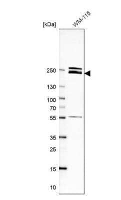 Western Blot: Laminin beta 1 Antibody [NBP1-88074] -  Analysis in human cell line WM-115.