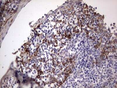 Immunohistochemistry: Laminin beta 3 Antibody (OTI3A2) - Azide and BSA Free [NBP2-71115] - Analysis of Human tonsil tissue. (Heat-induced epitope retrieval by 1 mM EDTA in 10mM Tris, pH8.5, 120C for 3min)