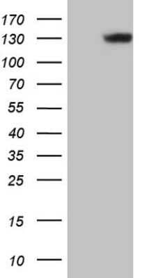 Western Blot: Laminin beta 3 Antibody (OTI9G3) - Azide and BSA Free [NBP2-71117] - Analysis of HEK293T cells were transfected with the pCMV6-ENTRY control (Left lane) or pCMV6-ENTRY Laminin beta 3.