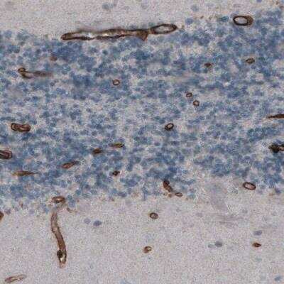 Immunohistochemistry-Paraffin: Laminin gamma 1 Antibody (CL3195) [NBP2-42394] - Staining of human cerebellum shows strong immunoreactivity in endothelium.