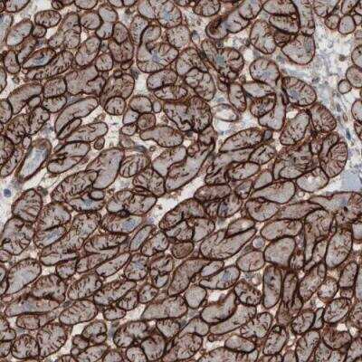 Immunohistochemistry-Paraffin: Laminin gamma 1 Antibody (CL3196) [NBP2-42395] - Staining of human heart shows strong membranous immunoreactivity in cardiomyocytes.