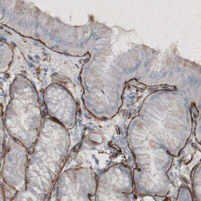 Immunohistochemistry-Paraffin: Laminin gamma 1 Antibody (CL3196) [NBP2-42395] - Staining of human stomach shows strong immunoreactivity in basement membrane of glandular epithelium.