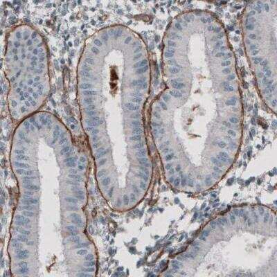 Immunohistochemistry-Paraffin: Laminin gamma 1 Antibody (CL3196) [NBP2-42395] - Staining of human endometrium shows strong positivity in basement membrane of glandular epithelium.