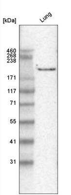 Western Blot: Laminin gamma 1 Antibody (CL3196) [NBP2-42395] - Analysis in human lung tissue.