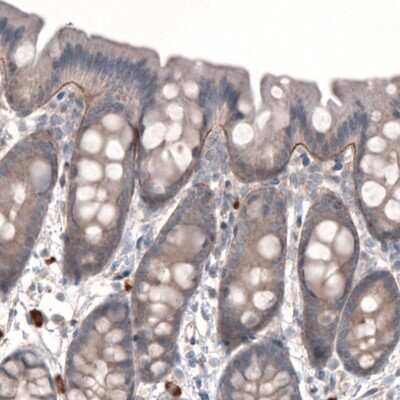 Immunohistochemistry-Paraffin: Laminin gamma 1 Antibody (CL3199) [NBP2-42396] - Staining or rat rectum shows immunoreactivity in basement membrane of glandular epithelium.