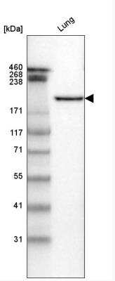 Western Blot: Laminin gamma 1 Antibody (CL3199) [NBP2-42396] - Analysis in human lung tissue.