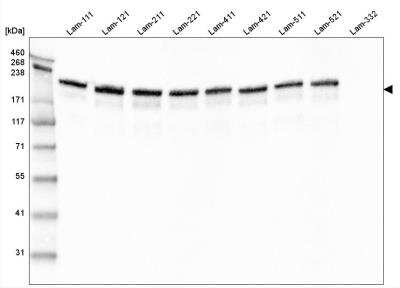 Western Blot: Laminin gamma 1 Antibody (CL3199) [NBP2-42396] - Analysis of purified human recombinant Laminin-111, Laminin-121, Laminin-211, Laminin-221, Laminin-411, Laminin-421, Laminin-511, Laminin-521 and Laminin-332.