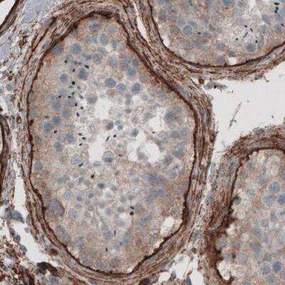 Immunohistochemistry-Paraffin: Laminin gamma 1 Antibody (CL3201) [NBP2-42397] - Staining of human testis shows immunoreactivity in basement membrane of seminiferous tubules.