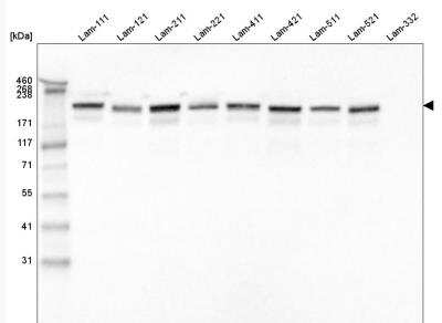 Western Blot: Laminin gamma 1 Antibody (CL3201) [NBP2-42397] - Analysis of purified human recombinant Laminin-111, Laminin-121, Laminin-211, Laminin-221, Laminin-411, Laminin-421, Laminin-511, Laminin-521 and Laminin-332.