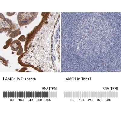 Immunohistochemistry-Paraffin: Laminin gamma 1 Antibody [NBP1-87718] - Staining in human placenta and tonsil tissues using anti-LAMC1 antibody. Corresponding LAMC1 RNA-seq data are presented for the same tissues.