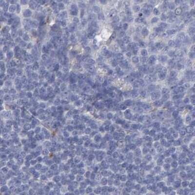 Immunohistochemistry-Paraffin: Laminin gamma 1 Antibody [NBP1-87718] - Staining of human tonsil using Anti-LAMC1 antibody NBP1-87718.