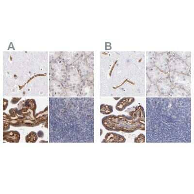 <b>Independent Antibodies Validation. </b>Immunohistochemistry-Paraffin: Laminin gamma 1 Antibody [NBP1-87719] - Staining of human cerebral cortex, kidney, placenta and tonsil using Anti-LAMC1 antibody NBP1-87719 (A) shows similar protein distribution across tissues to independent antibody NBP1-87718 (B).