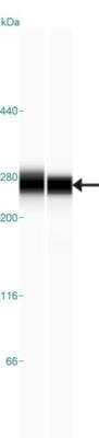 Simple Western: Laminin gamma 1 Antibody [NBP1-87718] - Simple Western lane view shows a specific band for  LAMC1 in 0.2 mg/ml of RT-4 (left) and U-251MG sp (right) lysate.  This experiment was performed under reducing conditions using the 66-440 kDa separation system.