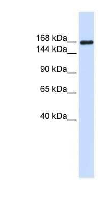 Western Blot: Laminin gamma 1 Antibody [NBP1-59144] - Titration: 0.2-1 ug/ml, Positive Control: Human Placenta.