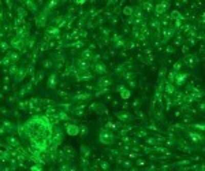 Immunocytochemistry/Immunofluorescence: Langerin/CD207 Antibody (808E10.01) [Alexa Fluor (R) 488] [DDX0360A488-100] - Staining of Langerin-transfected CHO cells.
