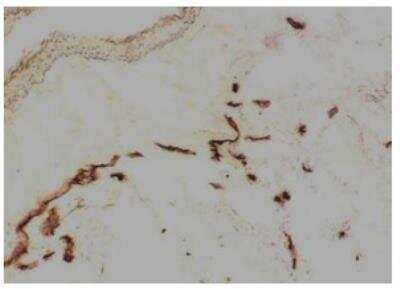 Immunohistochemistry: Langerin associated lectin Antibody (109B8.02) [DDX0350P-100] - Human lung frozen sectionstained with 109B8.02 (HRP)
