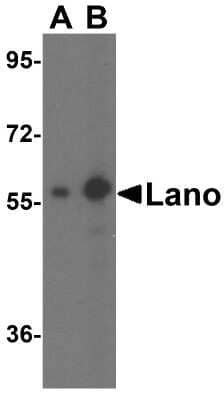 Western Blot: Lano Antibody [NBP1-76678] - Analysis of Lano expression in A431 cell lysate with Lano antibody at (A) 1 and (B) 2 ug/ml.