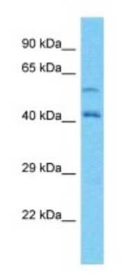Western Blot: Lano Antibody [NBP3-09508] - Western blot analysis of Lano in ACHN Whole Cell lysates. Antibody dilution at 1.0ug/ml