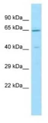 Western Blot: Lano Antibody [NBP3-09509] - Western blot analysis of Lano in 721_B Whole Cell lysates. Antibody dilution at 1.0ug/ml