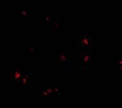 Immunohistochemistry: Lass5 Antibody [NBP1-77328] - Immunofluorescence of LASS5 in human brain tissue with LASS5 antibody at 20 ug/ml.