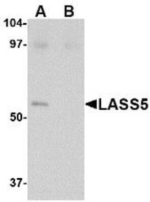 Western Blot: Lass5 Antibody [NBP1-77328] - SK-N-SH lysate with LASS5 antibody at 1 ug/ml in the (A) absence and (B) presence of blocking peptide.