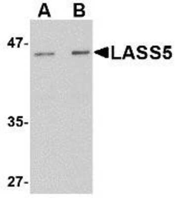 Western Blot: Lass5 Antibody [NBP1-77329] - Rat brain tissue lysate with LASS5 antibody at (A) 1 and (B) 2 ug/ml.